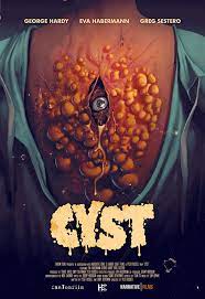 Cyst (2020) ซีสต์